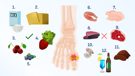 Dieta para la gota