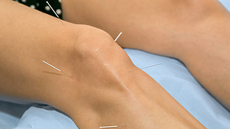 Artritis de rodilla tratamiento alternativo